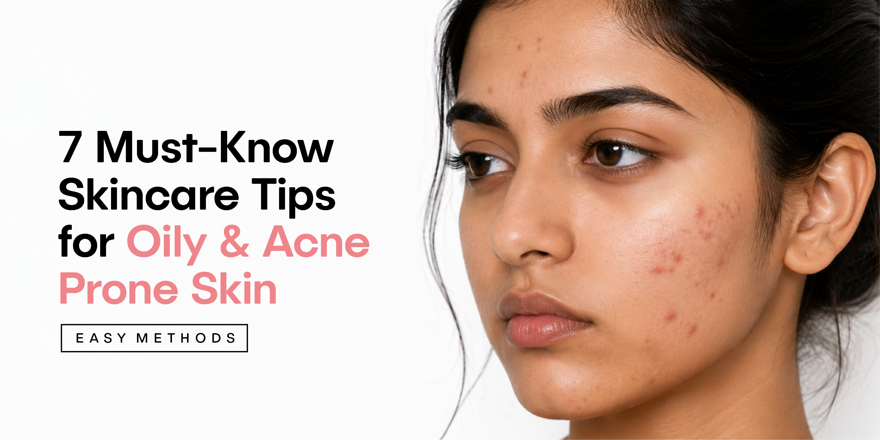 7 Must-Know Skincare Tips for Pimple Prone Oily Skin