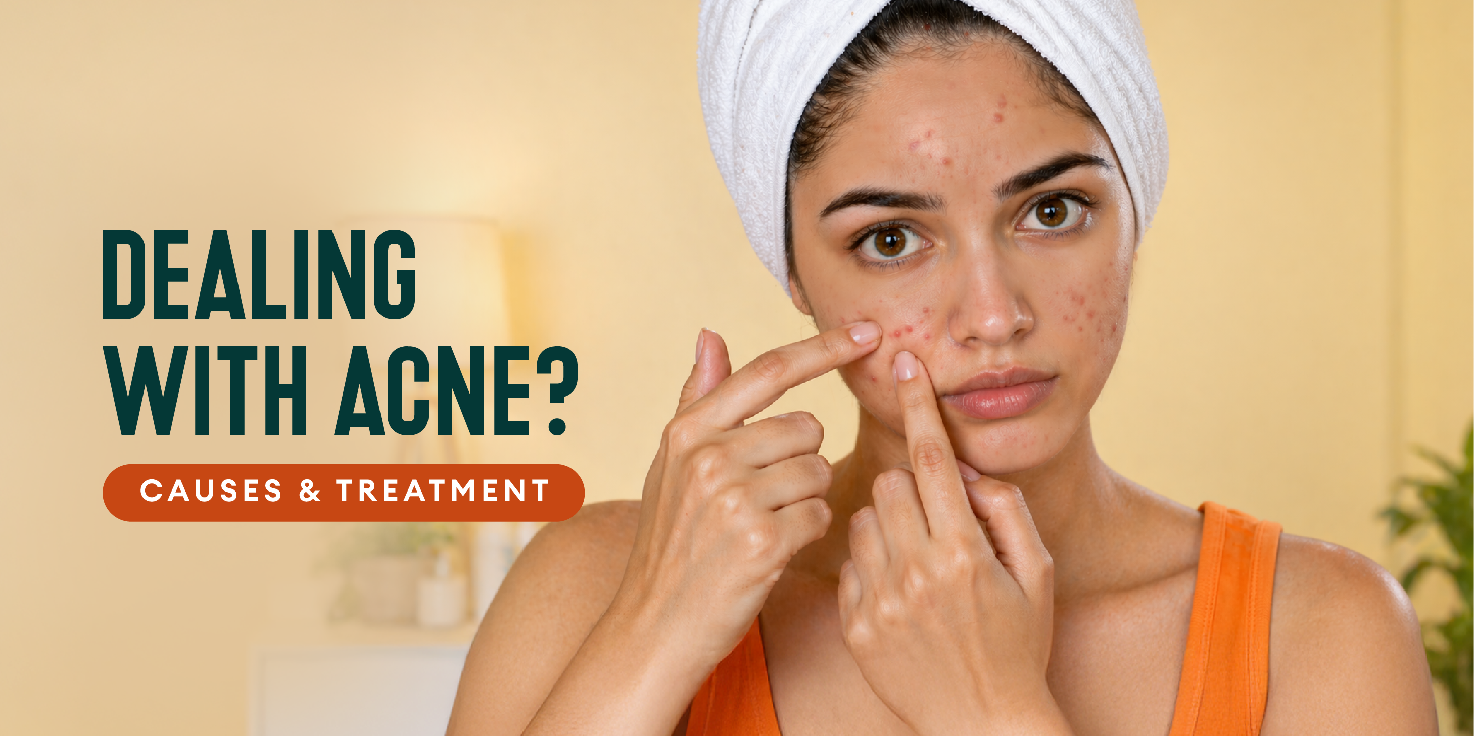 Acne: What It Is, Causes, Types, and How to Treat It