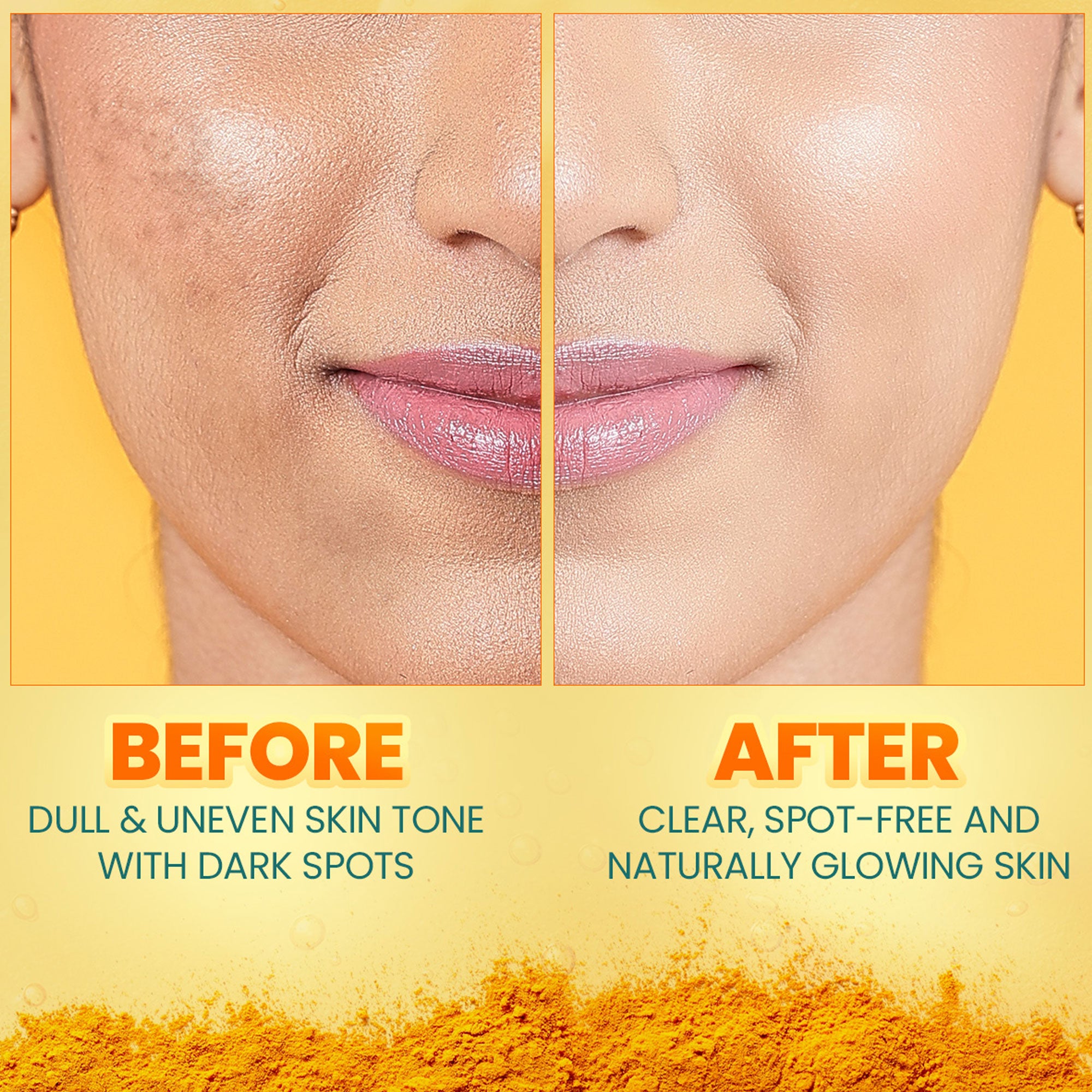 Himalaya Dark Spot Clearing Turmeric Kit - Before & After effects